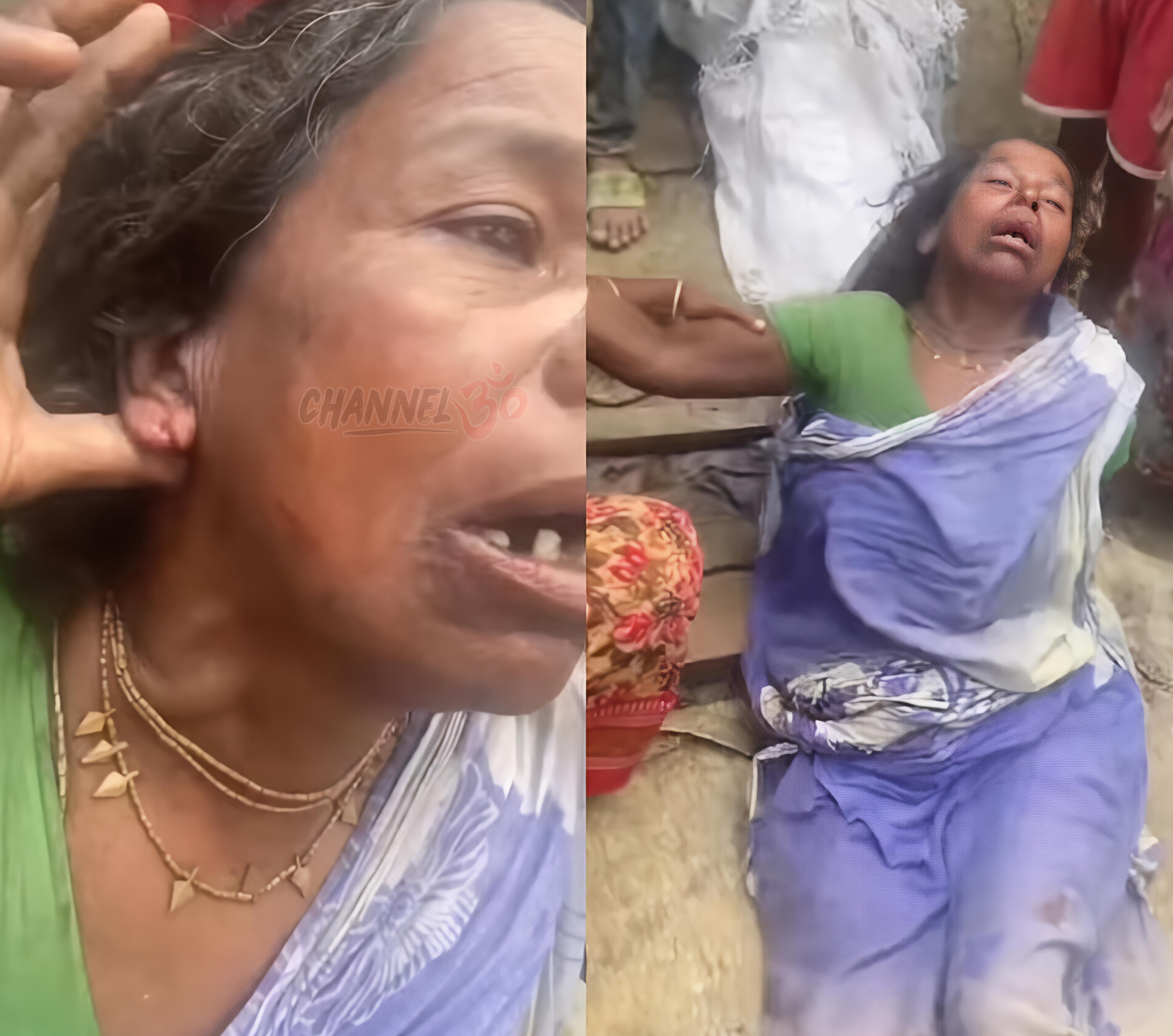 হাতিয়ায় হিন্দু মহিলার বাড়িতে ভয়াবহ ডাকাতি, দুল ছিনিয়ে নিতে কান কেটে নিল দুর্বৃত্তরা